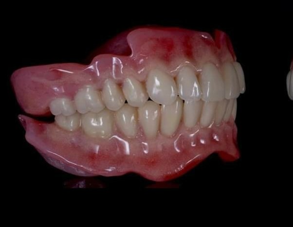 Private Dentures @ Dundee dental laboratory